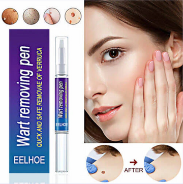 Warts Remover Original Cream